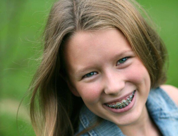 Kind orthodontie 2